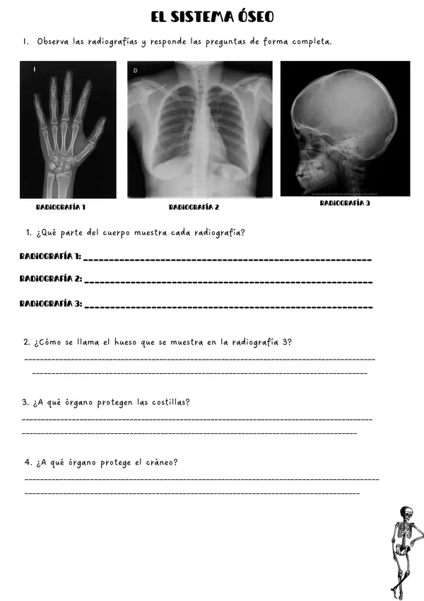 radiografias: sistema oseo
