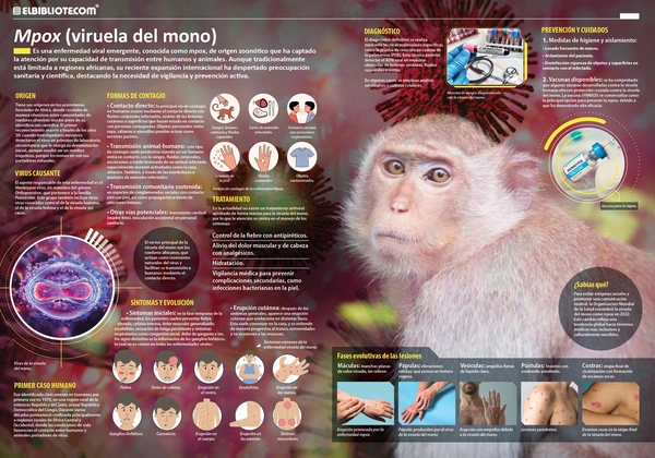Infografía viruela del mono