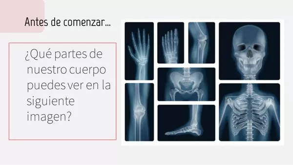 "El esqueleto"